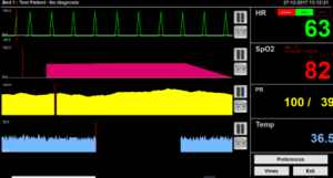 Simulation Heart Monitor 5 Simuladores de ritmos cardíacos para PC gratis - Mistertek.com